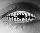 Skeletal Teeth