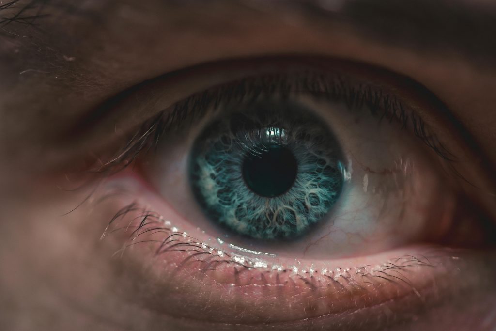 an image of a person with dry eye